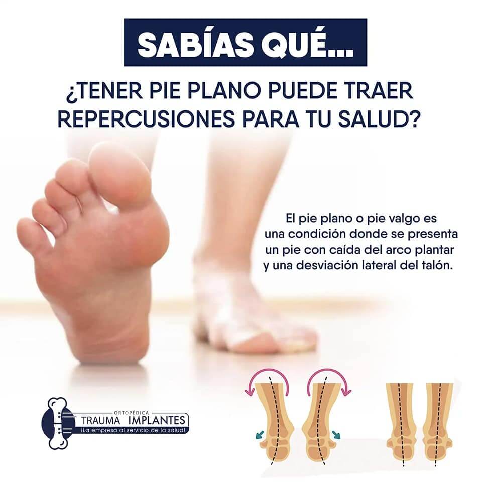 pie plano trauma implantes